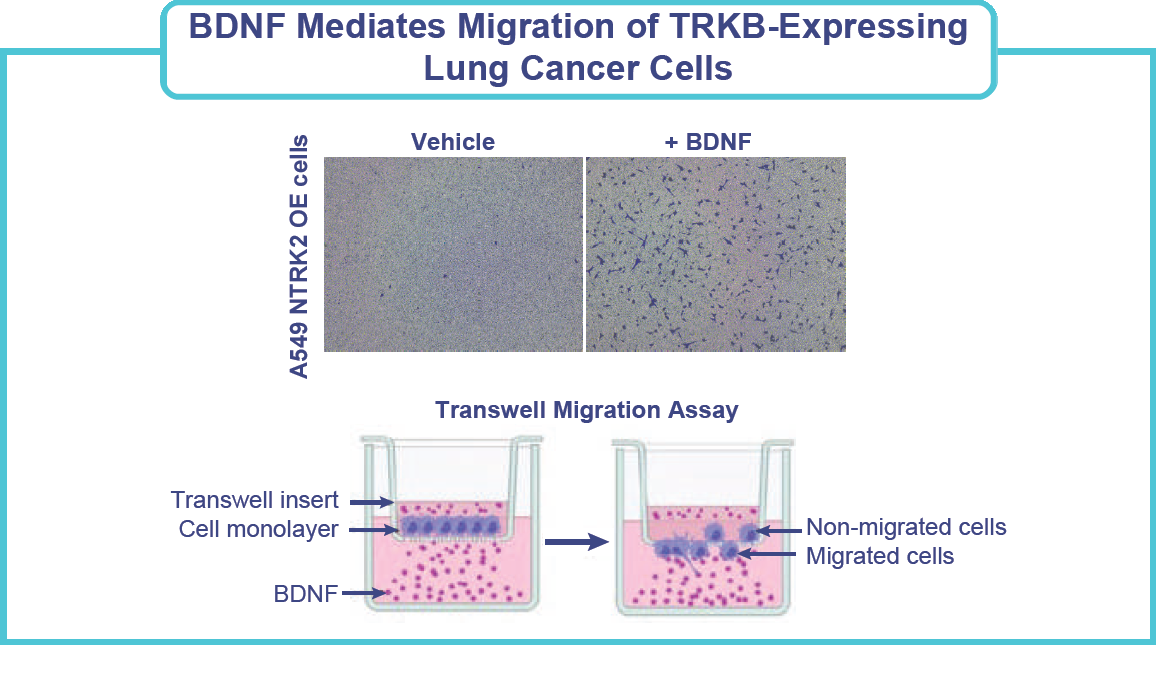 Figure: BDNF mediates migration of TRKB-expressing lung cancer cells