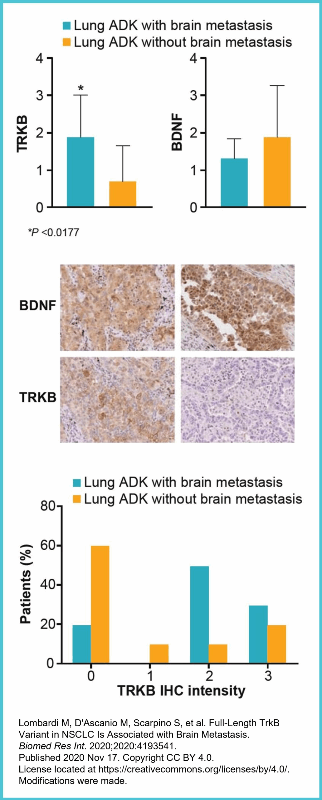 TRKB and BDNF figure